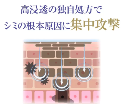 シミウス高浸透の儀くじ処方でシミの根本原因に集中攻撃